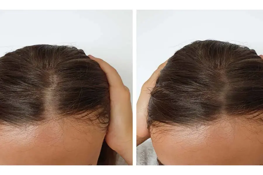 hair treatment before after